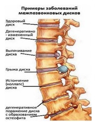Болит спина с правой стороны и отдает в живот