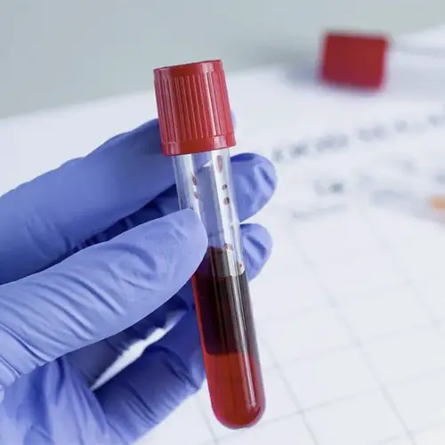 Забор крови бесплатно