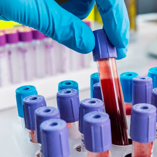 Скидка 10% на анализы